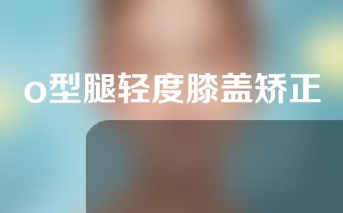 o型腿轻度膝盖矫正