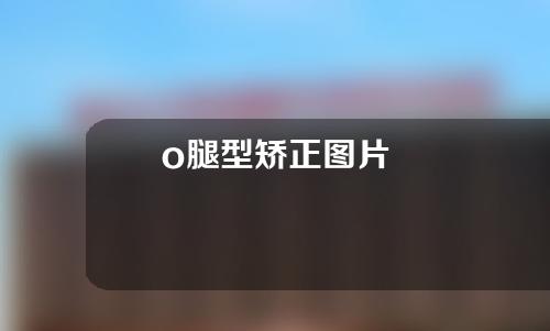 o腿型矫正图片