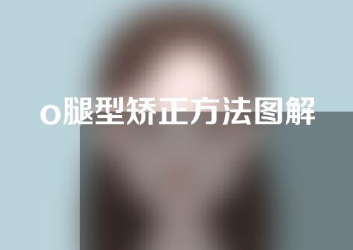 o腿型矫正方法图解