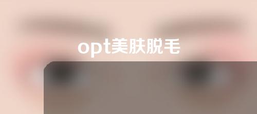 opt美肤脱毛