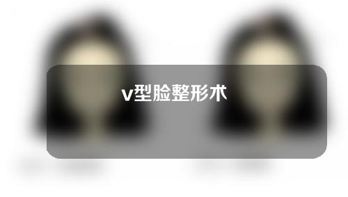 v型脸整形术