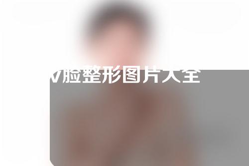 v脸整形图片大全