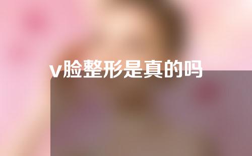 v脸整形是真的吗
