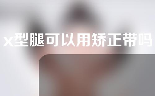x型腿可以用矫正带吗