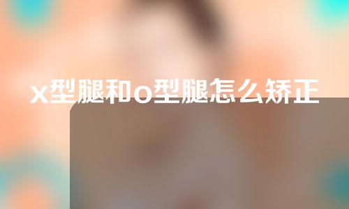 x型腿和o型腿怎么矫正