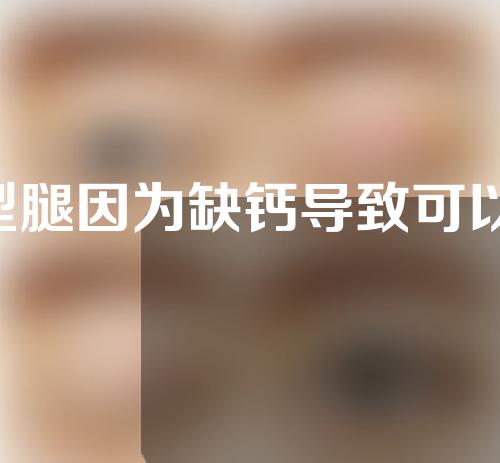 x型腿因为缺钙导致可以矫正吗