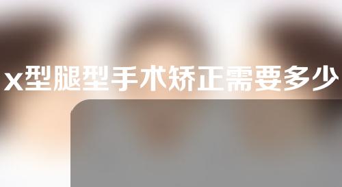 x型腿型手术矫正需要多少钱