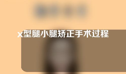 x型腿小腿矫正手术过程