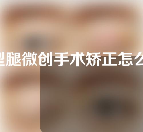 x型腿微创手术矫正怎么做