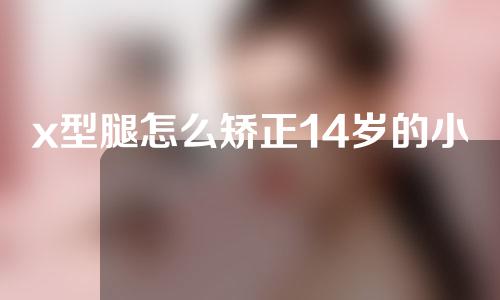 x型腿怎么矫正14岁的小孩