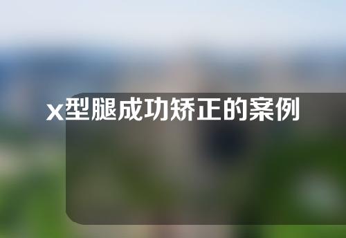 x型腿成功矫正的案例
