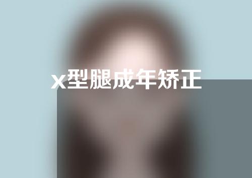 x型腿成年矫正