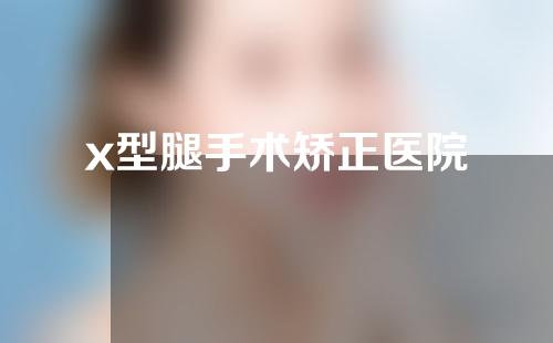 x型腿手术矫正医院