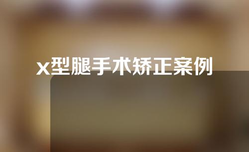 x型腿手术矫正案例