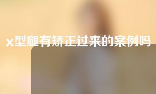 x型腿有矫正过来的案例吗