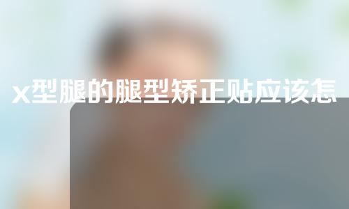 x型腿的腿型矫正贴应该怎么贴
