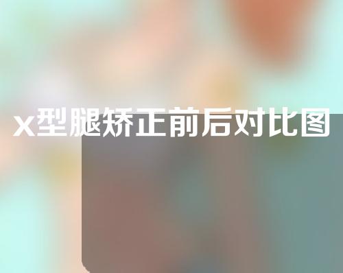 x型腿矫正前后对比图