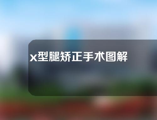 x型腿矫正手术图解