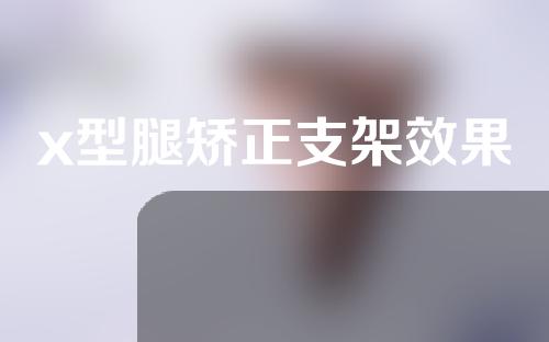 x型腿矫正支架效果