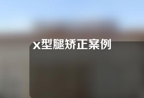 x型腿矫正案例