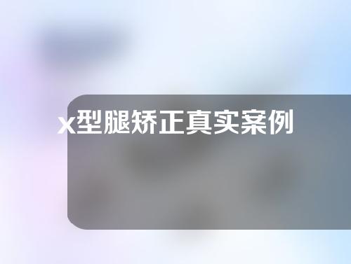 x型腿矫正真实案例