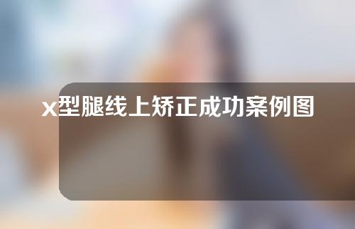 x型腿线上矫正成功案例图