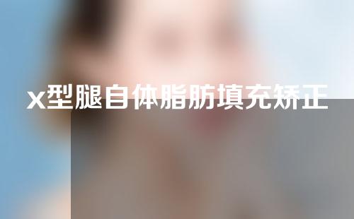 x型腿自体脂肪填充矫正