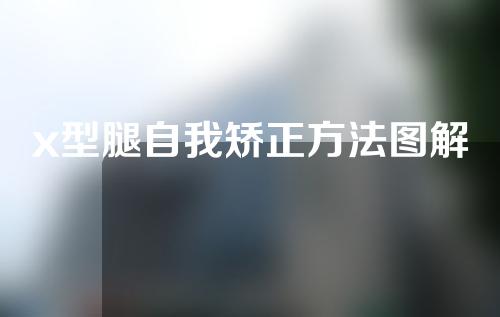 x型腿自我矫正方法图解