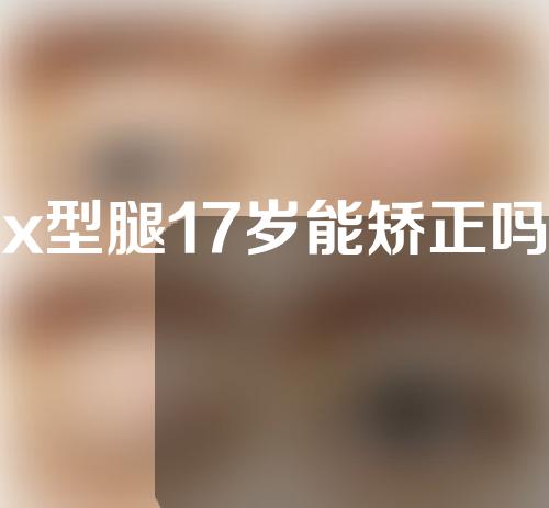 x型腿17岁能矫正吗