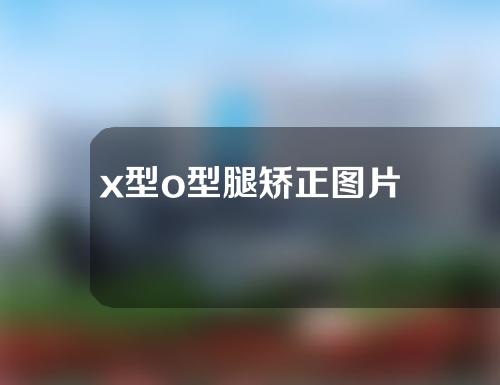 x型o型腿矫正图片