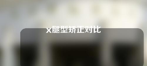 x腿型矫正对比